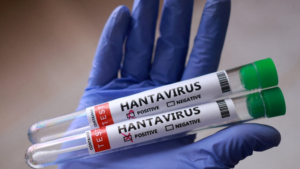 What Should You Know About a Virus Hantavirus Outbreak?